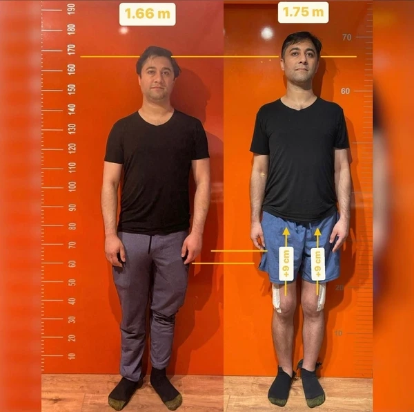 Height increase before and after example 2