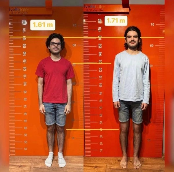 Height increase before and after example 3